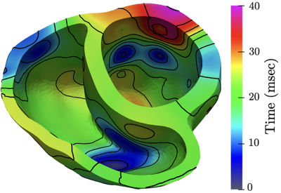 high-resolution simulation of the electrical activation map in a human’s heart