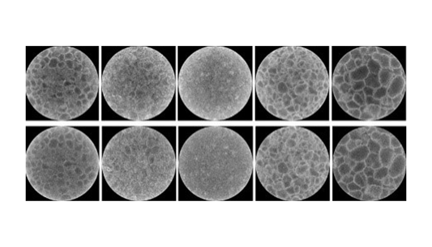 5x2 grid of circular grayscale images