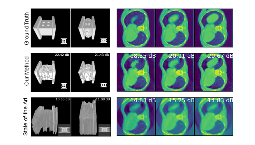 three rows of thoracic CT images with slight variations