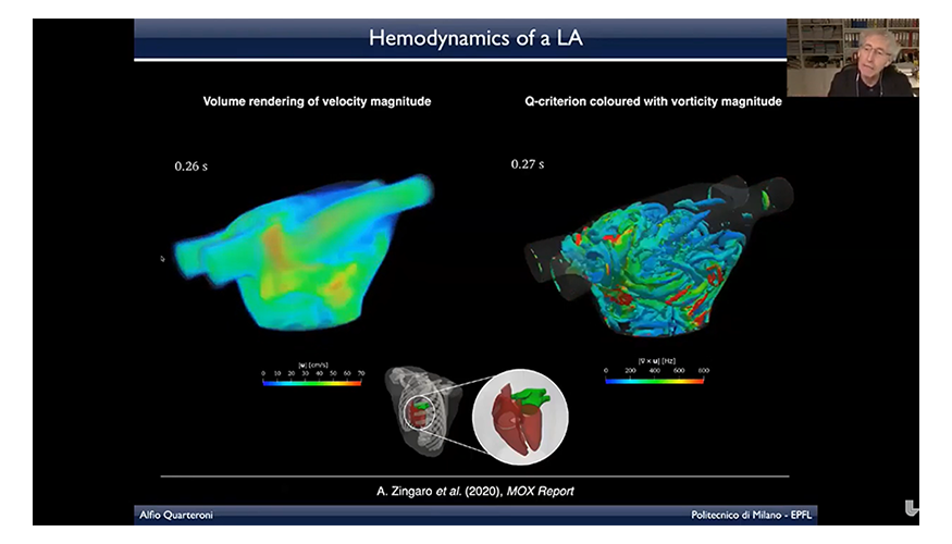 screen shot showing velocity and vorticity magnitude animations of a heart with the speaker in a video chat window at top right
