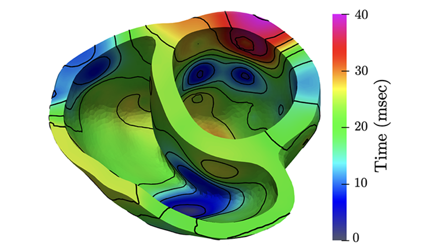  high-resolution simulation of the electrical activation map in a human’s heart