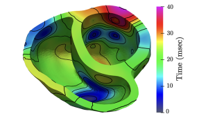  high-resolution simulation of the electrical activation map in a human’s heart