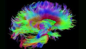colorful rendering of brain neurons